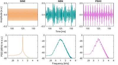 Pitch Matching in Cochlear Implant Users With Single-Sided Deafness: Effects of Electrode Position and Acoustic Stimulus Type